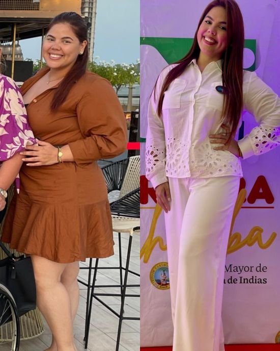 Antes y después paciente 3